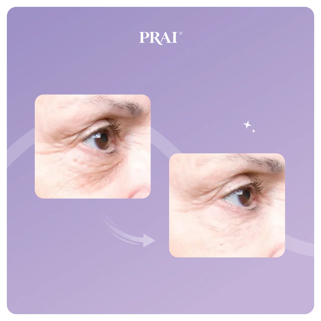 Ageless Eye Tight Uplift Serum - Image 3